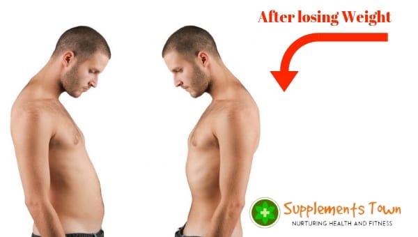 Become very thin after weight loss